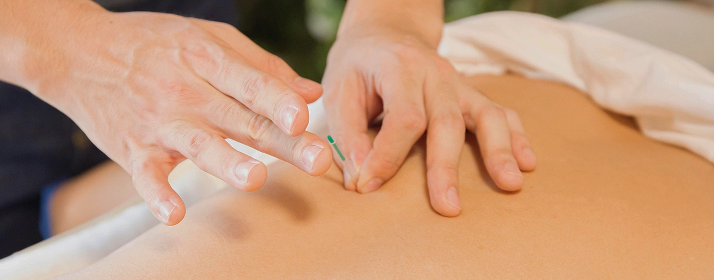 Dry Needling bij Fysiotherapie Eemnes